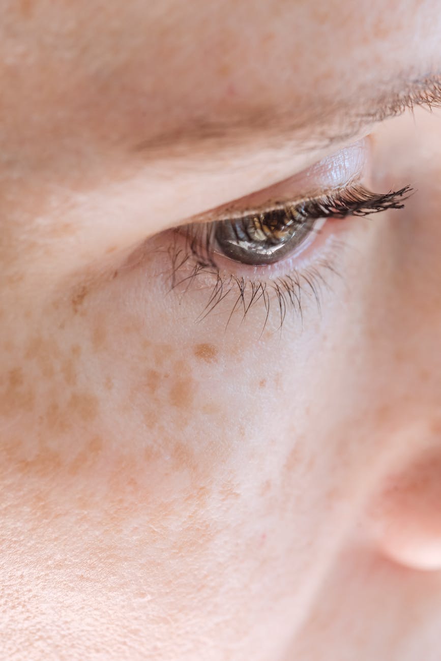 woman with freckles looking away